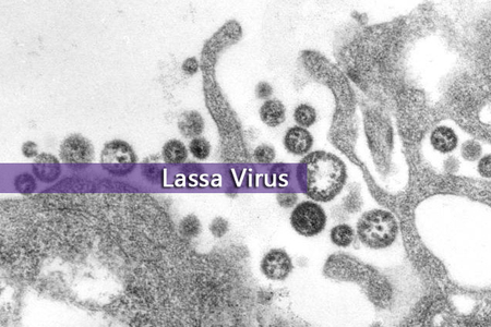 lassa virus