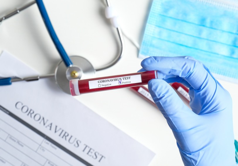 karonavirus test