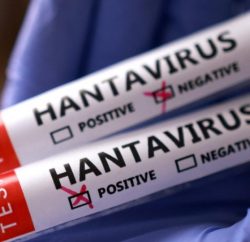 Hantavirus