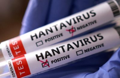 Hantavirus