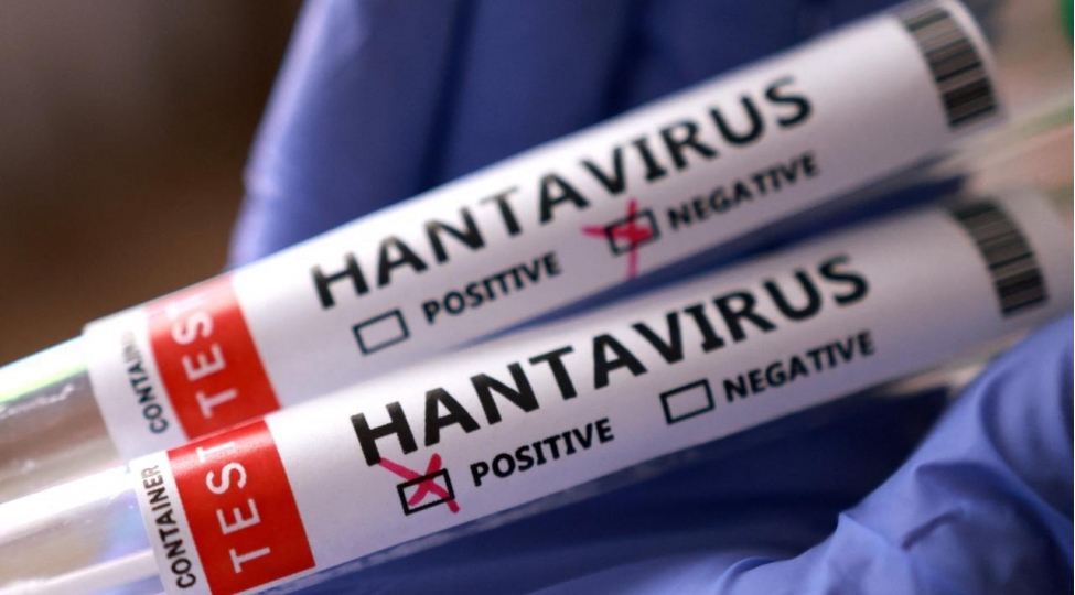 Hantavirus