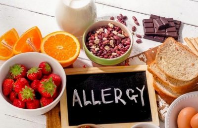 qoda allergiyasi